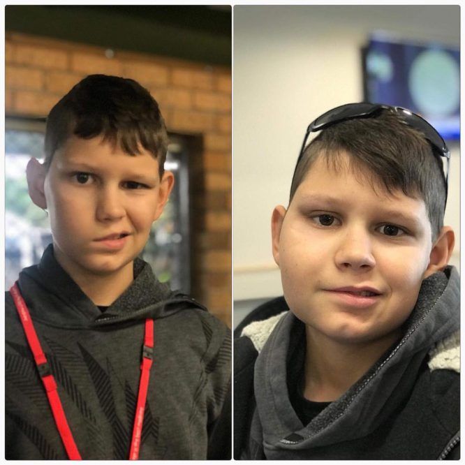 before-after